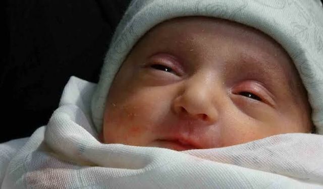 Nadir Tedaviyle Hayata Tutunan Bebek Dünyada 3. Vakaydı