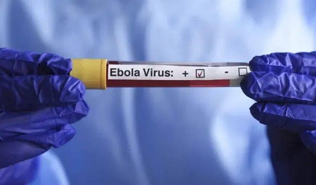 DSÖ'den Ebola salgını açıklaması: Seyahat kısıtlaması uygulanmamalı