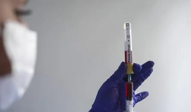 Kenya’da doğrulanan Ebola vakası 9’a yükseldi