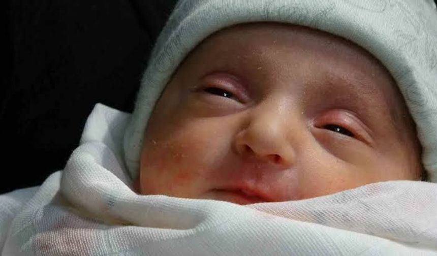 Nadir Tedaviyle Hayata Tutunan Bebek Dünyada 3. Vakaydı